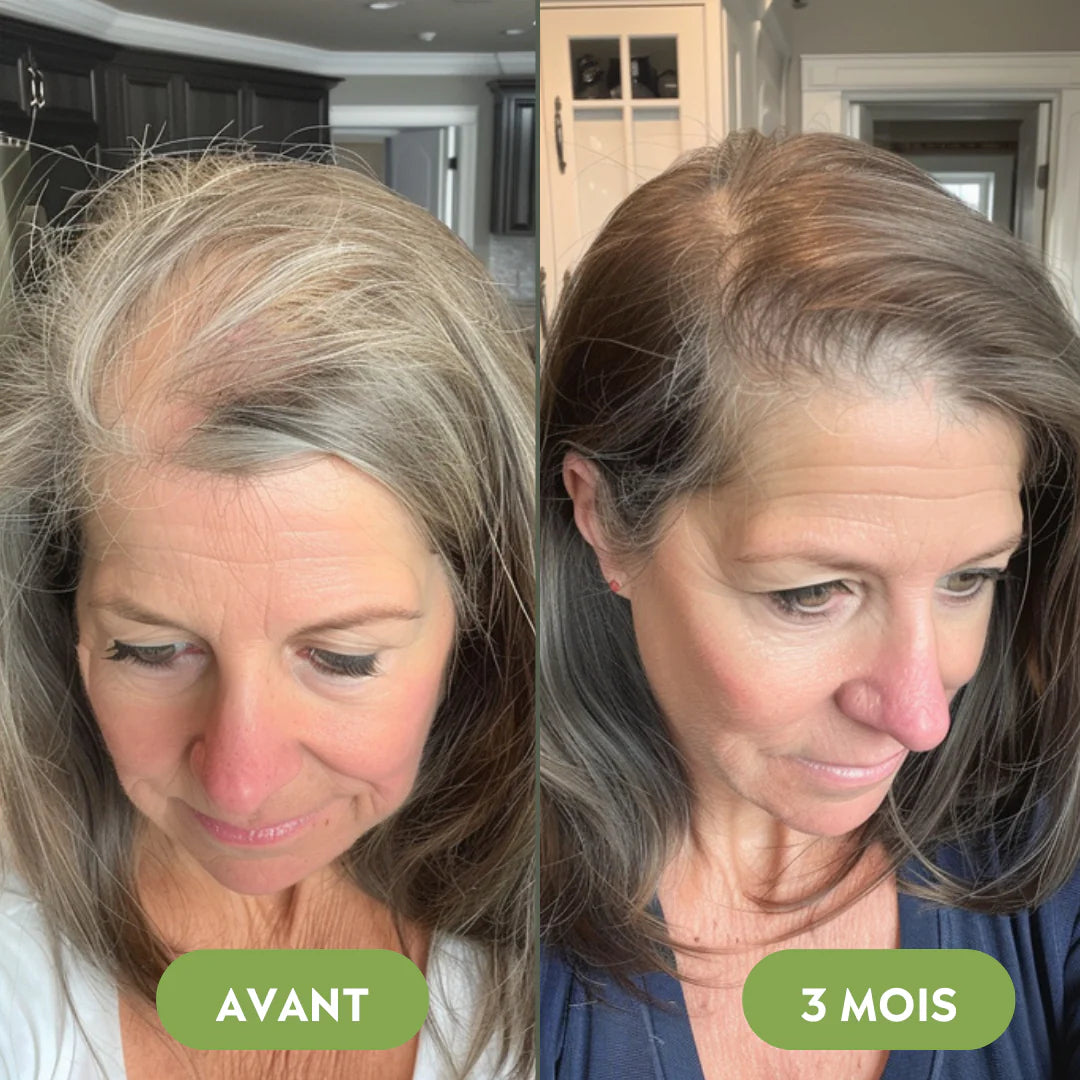 Hair growth serum (60ml)