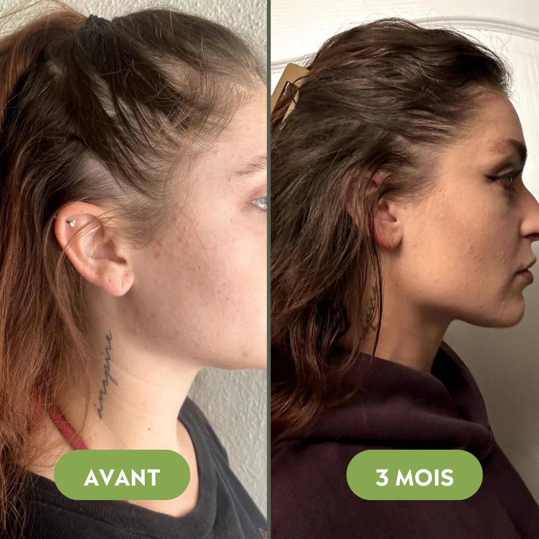 Hair growth serum (60ml)