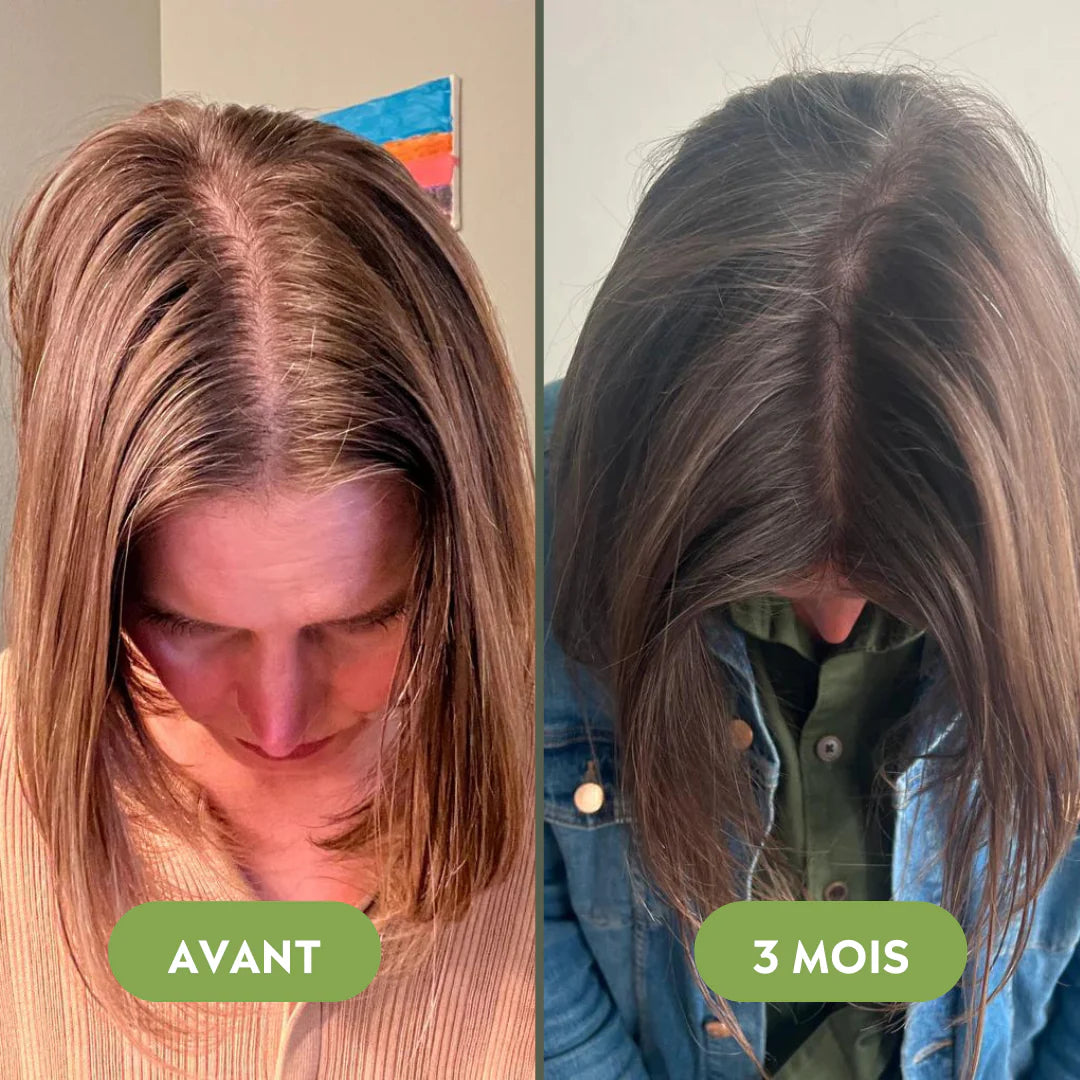 Hair growth serum (60ml)